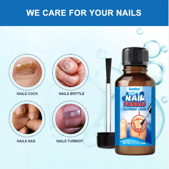 Nail Fungus Treatment Liquid (Original)