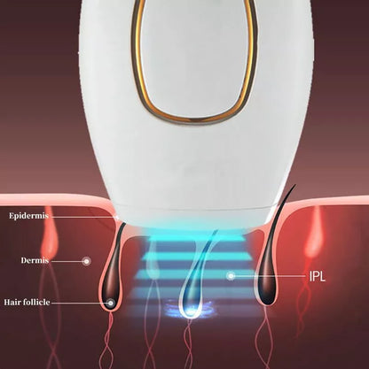 IPL Laser Hair Removal – جهاز إزالة الشعر بالليزر IPL